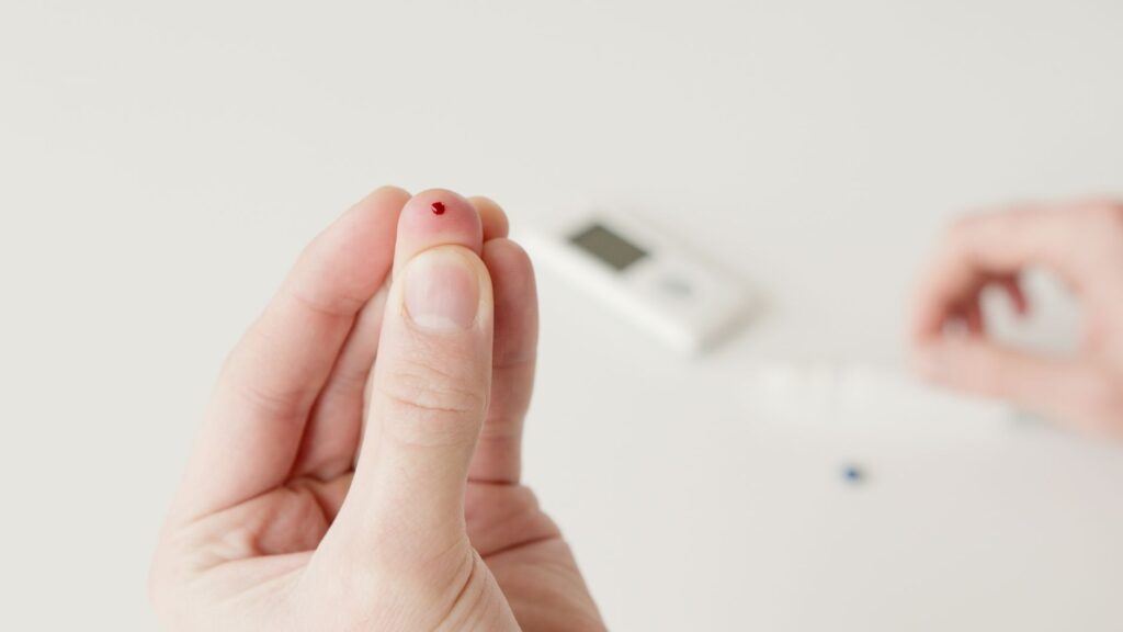 allergy skin prick test